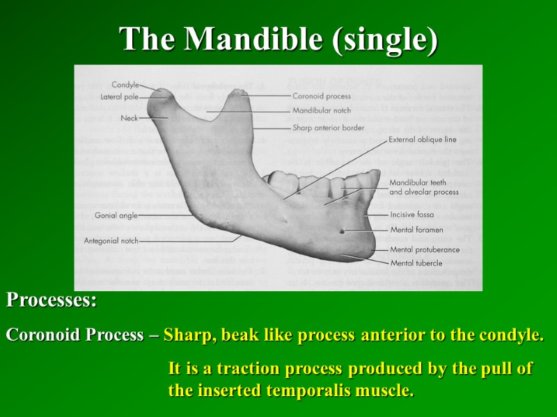 The Mandible (single)   Processes: Coronoid Process – Sharp, beak like process anterior